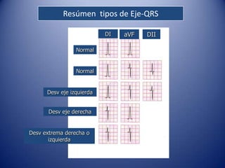 Resúmen tipos de Eje-QRS

                           DI   aVF   DII

                 Normal


                 Normal


      Desv eje izquierda


       Desv eje derecha


Desv extrema derecha o
       izquierda
 