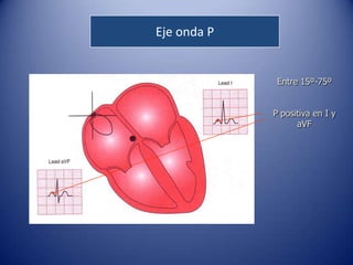 Eje onda P


              Entre 15º-75º


             P positiva en I y
                   aVF
 