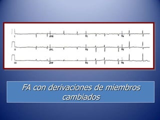 FA con derivaciones de miembros
           cambiados
 