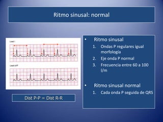Ritmo sinusal: normal


                         •   Ritmo sinusal
                             1.   Ondas P regulares igual
                                  morfología
                             2.   Eje onda P normal
                             3.   Frecuencia entre 60 a 100
                                  l/m


                         •   Ritmo sinusal normal
                             1.   Cada onda P seguida de QRS
Dist P-P = Dist R-R
 