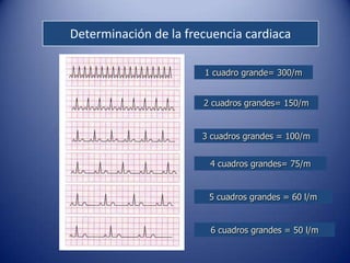 Determinación de la frecuencia cardiaca

                       1 cuadro grande= 300/m


                       2 cuadros grandes= 150/m


                       3 cuadros grandes = 100/m


                        4 cuadros grandes= 75/m


                        5 cuadros grandes = 60 l/m


                        6 cuadros grandes = 50 l/m
 