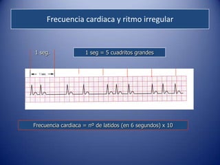 Frecuencia cardiaca y ritmo irregular


1 seg.              1 seg = 5 cuadritos grandes




Frecuencia cardiaca = nº de latidos (en 6 segundos) x 10
 