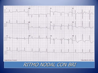 RITMO NODAL CON BRI
 