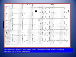 Varón de 85 años. Consulta por mareos y disnea. Antecedentes de insuficiencia cardiaca en
tratamiento con IECA y espironolactona.
 