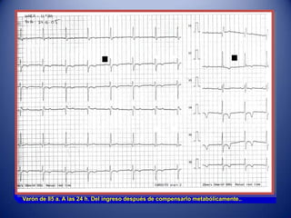 Varón de 85 a. A las 24 h. Del ingreso después de compensarlo metabólicamente..
 