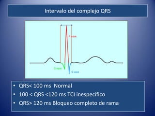 Intervalo del complejo QRS




• QRS< 100 ms Normal
• 100 < QRS <120 ms TCI inespecífico
• QRS> 120 ms Bloqueo completo de rama
 