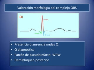 Valoración morfología del complejo QRS

       DI




•   Presencia o ausencia ondas Q
•   Q diagnóstica
•   Patrón de pseudoinfarto: WPW
•   Hemibloqueo posterior
 