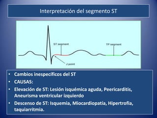 Interpretación del segmento ST




• Cambios inespecíficos del ST
• CAUSAS:
• Elevación de ST: Lesión isquémica aguda, Peericarditis,
  Aneurisma ventricular izquierdo
• Descenso de ST: Isquemia, Miocardiopatía, Hipertrofia,
  taquiarritmia.
 