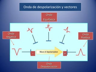 Onda de despolarización y vectores

                          Onda
                        Equifásica




 Onda                                            Onda
negativa                                        Positiva




                -                       +


                          Onda
                      Despolarización
 