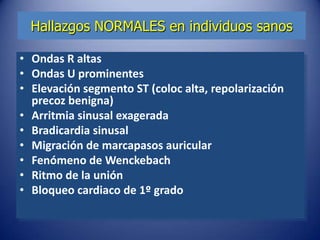 Hallazgos NORMALES en individuos sanos

• Ondas R altas
• Ondas U prominentes
• Elevación segmento ST (coloc alta, repolarización
  precoz benigna)
• Arritmia sinusal exagerada
• Bradicardia sinusal
• Migración de marcapasos auricular
• Fenómeno de Wenckebach
• Ritmo de la unión
• Bloqueo cardiaco de 1º grado
 