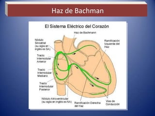 Haz de Bachman
 