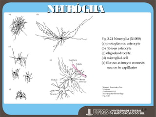NE
URÓGL
IA

Prof. Ronny M de Moraes 118

118

 