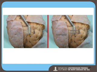 Prof. Ronny M de Moraes 181

181

 