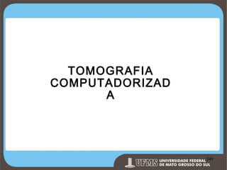 TOMOGRAFIA
COMPUTADORIZAD
A

Prof. Ronny M de Moraes 249

249

 