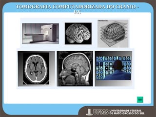 TOMOGRAFIA COMPUTADORIZADA DO CRÂNIO RX

Fonte: www.alzheimermed.com.br

Prof. Ronny M de Moraes 250

250

 