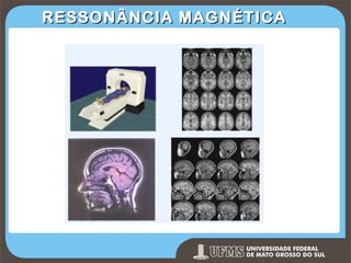 RESSONÂNCIA MAGNÉTICA

Prof. Ronny M de Moraes 257

257

 
