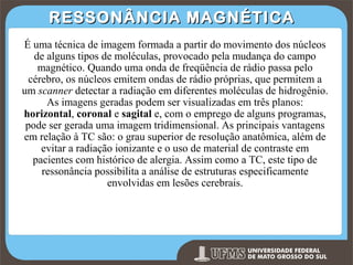 RESSONÂNCIA MAGNÉTICA
É uma técnica de imagem formada a partir do movimento dos núcleos
de alguns tipos de moléculas, provocado pela mudança do campo
magnético. Quando uma onda de freqüência de rádio passa pelo
cérebro, os núcleos emitem ondas de rádio próprias, que permitem a
um scanner detectar a radiação em diferentes moléculas de hidrogênio.
As imagens geradas podem ser visualizadas em três planos:
horizontal, coronal e sagital e, com o emprego de alguns programas,
pode ser gerada uma imagem tridimensional. As principais vantagens
em relação à TC são: o grau superior de resolução anatômica, além de
evitar a radiação ionizante e o uso de material de contraste em
pacientes com histórico de alergia. Assim como a TC, este tipo de
ressonância possibilita a análise de estruturas especificamente
envolvidas em lesões cerebrais.

Prof. Ronny M de Moraes 258

258

 