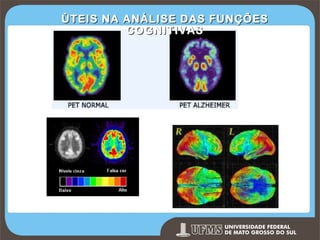 ÙTEIS NA ANÁLISE DAS FUNÇÕES
COGNITIVAS

Prof. Ronny M de Moraes 264

264

 