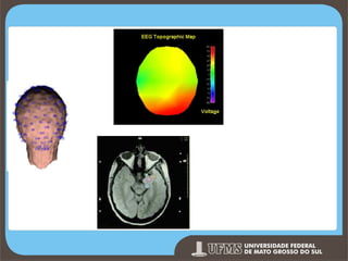 Eletroencefalogr
ama Topográfico

MRI - Magnetic Resonance
Imaging MEG Magnetoencephalograph

Prof. Ronny M de Moraes 272

272

 