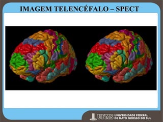 IMAGEM TELENCÉFALO – SPECT

Prof. Ronny M de Moraes 51

 