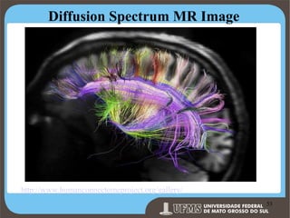Diffusion Spectrum MR Image

http://www.humanconnectomeproject.org/gallery/

Prof. Ronny M de Moraes 53

53

 