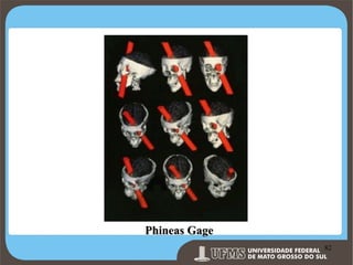 Phineas Gage
Prof. Ronny M de Moraes 82

82

 