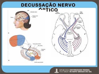 DECUSSAÇÃO NERVO
ÓPTICO

Prof. Ronny M de Moraes 84

 