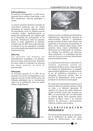 FUNDAMENTOS DE ONCOLOGÍA
Enfermedad ósea
Al momento del diagnóstico un 60% de los
pacientes tienen lesiones óseas líticas y otro
20% osteoporosis, fracturas patológicas o
ambos.
Lo anterior producto del factor activador de
osteoclastos producido pos las células
plasmáticas de mieloma. Algunos estudios
han identificado a la IL-1b. Debido a que los
esteroides inhiben significativamente su
producción posiblemente esto explique algo
de la efectividad del medicamento en los
pacientes. Virtualmente todos los pacientes
tienen un grado significativo de osteolisis,
mientras que sólo 20% tienen hipercalcemia.
Los Rayos X son más específicos y sensibles
que la estincigrafía (gamagrafía) para detectar
compromiso óseo.
Infección
Los pacientes con mieloma son
particularmente susceptibles a la infección,
que es la mayor causa de muerte. El periodo
de mayor riesgo lo constituyen los primeros
dos meses posterior al inicio de
quimioterapia.
Nefropatía
Se encuentra presente en un 20% de los
pacientes al momento del diagnóstico y es la
segunda causa de muerte más frecuente. Los
hallazgos patológicos que se correlacionan
mejor con la insuficiencia renal son atrofia
tubular y degeneración.

Imagen radiográfica de un paciente con mieloma en
craneo

Aunque muchas complicaciones del mieloma
(hipercalcemia, hiperuricemia, síndrome de
hiperviscosidad, infección y amiloidosis)
pueden contribuir al daño renal, el factor más
importante es la presencia de proteinuria de
Bence Jones (cadenas ligeras libres). Estos
pacientes tienen mayor probabilidad de
disminución de la depuración de creatinina,
sin embargo hay pacientes que presentan
dicha proteinuria y no manifiestan afección
renal, por lo que no es el único determinante
para la insuficiencia renal.
La insuficiencia renal ocurre en pacientes con
mieloma, usulamente cuentan con
proteinuria de Bence Jones e hipercalcemia.
Los estados de deshidratación, el sangrado
gastrointestinal significativo con hipovolemia,
el uso de antibióticos nefrotóxicos o la
pielografía intravenosa reciente, aún en
ausencia de deshidratación clínica pueden
precitipar una insuficiencia renal aguda.
El compromiso renal también puede tomar la
forma de disfunción tubular proximal o distal
sin daño a la filtración glomerular. El
síndrome de Fanconi del adulto (disfunción
tubular proximal) puede estar asociado con
MM y es comúnmente visto con enfermedad
de cadenas ligeras. Estos pacientes tienen
proteína de Bence Jones y los síntomas
clásicos de glucosuria, aminoaciduria,
fosfaturia, acidosis y osteomalacia.

C L A S I F I C A C I O N
PATOLOGICA
Imagen radiográfica de un mieloma en columna dorsal

El tumor de células plasmáticas, se caracteriza
por la proliferación de células con varios
grados de diferenciación. Las células

99

 