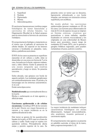 DR. EDWIN CEVALLOS BARRERA
1.
2.
3.
4.
5.

Superficial
Nodular
Pigmentado
Morrea
Adenoideoquístico.

El carcinoma basoescamoso combina rasgos
histológicos de tumor basocelular y
c a rc i n o m a d e c é l u l a s b á s a l e s . L a
Organización Mundial de la Salud propuso
para la misma lesión el término de carcinoma
metatípico.
El comportamiento biológico y tratamiento es
el mismo que el aplicado al carcinoma de
células básales. En especial en las lesiones
cercanas o localizadas en párpados, nariz,
labios y pabellones auriculares.

presenta como un tumor que se descama,
ligeramente sobreelevado y con borde
irregular, casi siempre con ulceración crónica
superficial y son exofíticas.
De modo global, los carcinomas
epidermoides generan metástasis en 8% de
los casos. Los tumores poco diferenciados de
más de 0.5 cm de espesor, los que se originan
en fístulas crónicas, cicatrices por
quemaduras o zonas radiadas, aquellos
localizados en uniones mucocutáneas y los
originados en una enfermedad de Bowen
tienen peor pronóstico, mayor riesgo de
metástasis (0.5 hasta 30%), por lo general a
ganglios linfáticos regionales, pero pueden
metastatizar a huesos, pulmón o cerebro.

El 95% de los casos se presenta en superficies
expuestas al sol: cabeza y cuello, éstas se
desarrollan en una zona con forma de T en la
cara, formada por la frente, regiones malares,
nariz y labio inferior. Existe la presencia de
una escara sangrante que cicatriza
parcialmente y luego se ulcera. Se presenta
una zona.
Sobre elevada, rojo grisáceo con borde de
aspecto perlado. Las metástasis ganglionares
son extraordinariamente raras. El prurito y la
hemorragia son los síntomas característicos.
3, 4, 5,12
Existe varios tipos como:
Noduloulcerado que eventualmente lleva a
la muerte.
Morfea o esclerosante es el más agresivo y
difícil de tratar.
Carcinoma epidermoide o de células
escamosas. Constituye 20% de los tumores
de la piel. Ocurre con mayor frecuencia en
varones y su mayor incidencia es en la
séptima década de la vida.
Este tumor se genera de los queratinocitos
basales de la piel y el 95% nace en el área de
cabeza y cuello. Suele surgir en sujetos con
queratosis actínica. Principalmente afecta
orejas y porción superior de la cara. Se

116

La mayor incidencia de metástasis incluyen
características histológicas con escasa
diferenciación, huésped inmunodeficiente,
sitio anatómico, invasión perineural y
crecimiento rápido.
El comportamiento más agresivo se presenta
en pabellón auricular, el dorso de la mano,
labio y regiones temporales.5, 12.

 