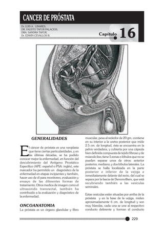 CANCER DE PRÓSTATA
Dr. LUIS A. LINARES,
DR. FAUSTO TAFUR PALACIOS,
DRA. SANDRA TAFUR,
Dr. EDWIN CEVALLOS B.

GENERALIDADES

E

l cáncer de próstata es una neoplasia
que tiene ciertas particularidades, y en
las últimas décadas, se ha podido
conocer mejor la enfermedad, en función del
descubrimiento del Antígeno Prostático
Específico (APE: español o PSA: inglés), este
marcador ha permitido un diagnóstico de la
enfermedad en etapas incipientes y también,
hacer uso de él para monitoreo, evaluación y
ensayo de las diferentes formas de
tratamiento. Otros medios de imagen como el
ultrasonido transrectal, también ha
contribuido a la evaluación y diagnóstico de
la enfermedad.

ONCOANATOMIA
La próstata es un órgano glandular y fibro

Capítulo

16

muscular, pesa al rededor de 20 gm, contiene
en su interior a la uretra posterior que mide
2.5 cm. de longitud, ésta se encuentra en la
pelvis verdadera, y cubierta por una cápsula
bien definida compuesta de tejido fibroso y de
músculo liso, tiene 5 zonas o lóbulos que no se
pueden separar unos de otros: anterior
posterior, mediano, y dos lóbulos laterales. La
próstata se halla localizada en la parte
posterior e inferior de la vejiga e
inmediatamente delante del recto, del cual se
separa por la fascia de Denonvilliers, que está
recubriendo también a las vesículas
seminales.
Estas vesículas están situadas por arriba de la
próstata y en la base de la vejiga, miden
aproximadamente 6 cm. de longitud y son
muy blandas, cada una se une al respectivo
conducto deferente y forman el conducto

229

 