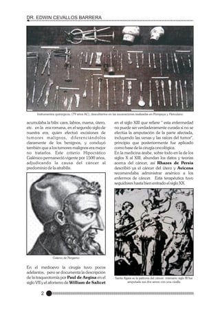 DR. EDWIN CEVALLOS BARRERA

Instrumentos quirúrgicos, (79 años AC), descubiertos en las excavaciones realizadas en Pompeya y Herculano

acumulaba la bilis: cara, labios, mama, útero,
etc. en la era romana, en el segundo siglo de
nuestra era, quien efectuó excisiones de
tumores malignos, diferenciándolos
claramente de los benignos, y concluyó
también que a los tumores malignos era mejor
no tratarlos. Este criterio Hipocrático
Galénico permaneció vigente por 1500 años,
adjudicando la causa del cáncer al
predominio de la atrabilis.

en el siglo XIII que refiere " esta enfermedad
no puede ser verdaderamente curada si no se
efectúa la amputación de la parte afectada,
incluyendo las venas y las raíces del tumor",
principio que posteriormente fue aplicado
como base de la cirugía oncológica.
En la medicina árabe, sobre todo en la de los
siglos X al XIII, abundan los datos y teorías
acerca del cáncer, así Rhazes de Persia
describió ya el cáncer del útero y Avicena
recomendaba administrar arsénico a los
enfermos de cáncer. Esta terapéutica tuvo
seguidores hasta bien entrado el siglo XX.

Galeno de Pergamo

En el medioevo la cirugía tuvo pocos
adelantos, pero se documenta la descripción
de la traqueotomía por Paul de Aegina en el
siglo VII y el aforismo de William de Salicet

2

Santa Agata es la patrona del cáncer mamario siglo III fue
amputada sus dos senos con una cizalla

 