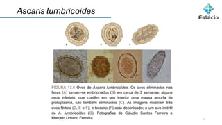 Ascaris lumbricoides
13
 
