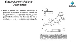 Enterobius vermicularis –
Diagnóstico
34
• Fazer o exame pela manhã, assim que o
paciente levantar-se e antes de banhar-se;
ou, pelo menos, no período matinal, pois a
positividade diminui no decurso do dia, à
medida que os ovos se desprendem da pele.
 