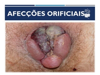 AFECÇÕES ORIFICIAIS
 