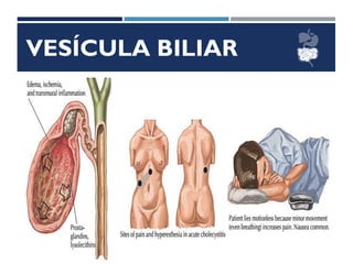 VESÍCULA BILIAR
Fundo
Corpo
Infundíbulo
 