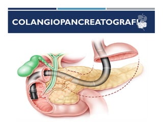 COLANGIOPANCREATOGRAFIA
 