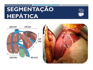 SEGMENTAÇÃO
HEPÁTICA
 
