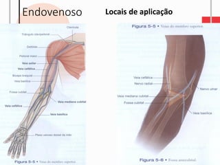 Endovenoso Locais de aplicação
 