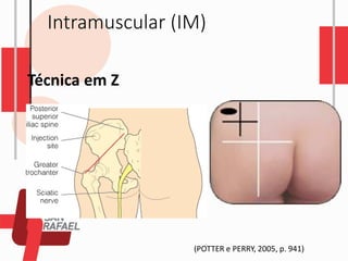 Intramuscular (IM)
Técnica em Z
(POTTER e PERRY, 2005, p. 941)
 