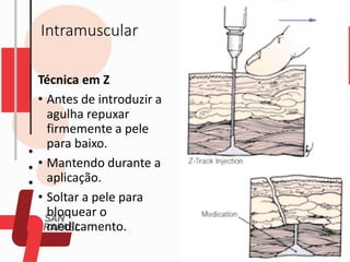Intramuscular
Técnica em Z
• Antes de introduzir a
agulha repuxar
firmemente a pele
para baixo.
• Mantendo durante a
aplicação.
• Soltar a pele para
bloquear o
medicamento.
 