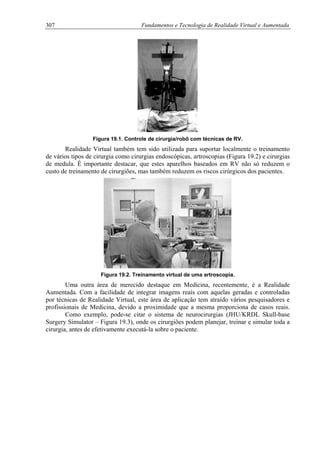 307 Fundamentos e Tecnologia de Realidade Virtual e Aumentada
Figura 19.1. Controle de cirurgia/robô com técnicas de RV.
Realidade Virtual também tem sido utilizada para suportar localmente o treinamento
de vários tipos de cirurgia como cirurgias endoscópicas, artroscopias (Figura 19.2) e cirurgias
de medula. É importante destacar, que estes aparelhos baseados em RV não só reduzem o
custo de treinamento de cirurgiões, mas também reduzem os riscos cirúrgicos dos pacientes.
Figura 19.2. Treinamento virtual de uma artroscopia.
Uma outra área de merecido destaque em Medicina, recentemente, é a Realidade
Aumentada. Com a facilidade de integrar imagens reais com aquelas geradas e controladas
por técnicas de Realidade Virtual, este área de aplicação tem atraído vários pesquisadores e
profissionais de Medicina, devido a proximidade que a mesma proporciona de casos reais.
Como exemplo, pode-se citar o sistema de neurocirurgias (JHU/KRDL Skull-base
Surgery Simulator – Figura 19.3), onde os cirurgiões podem planejar, treinar e simular toda a
cirurgia, antes de efetivamente executá-la sobre o paciente.
 