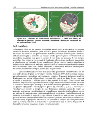 360 Fundamentos e Tecnologia de Realidade Virtual e Aumentada
Figura 26.2. Ambiente de planejamento apresentando a fusão dos dados de
ressonância magnética (modelo de arame), angiografia e tomografia do cérebro de
um paciente [Guan, 1998].
26.3. Assistência
A assistência oferecida por sistemas de realidade virtual utiliza a sobreposição de imagens,
através de realidade aumentada, para auxiliar e prover informações relevantes durante a
realização ou estudo de um procedimento. Sistemas desse tipo voltados para a medicina
utilizam informações e conjuntos de imagens obtidas por tomografia computadorizada ou
ressonância magnética para gerar o volume de um órgão ou estrutura de um paciente
específico. Esse volume pré-processado é visualizado sobreposto ao mundo real para auxiliar
o planejamento ou execução de um procedimento. Nesse caso, os médicos visualizam o
volume virtual sobreposto ao paciente e podem identificar estruturas anatômicas existentes no
local de interesse, como veias, artérias ou tumores, e analisam os pontos de intervenção ou
realizam o procedimento cirúrgico guiados pela imagem virtual.
Um dos sistemas de assistência mais conhecidos que utilizam realidade virtual está em
uso em Boston no Brigham and Women’s Hospital [Grimson, 1999]. Este sistema é utilizado
para planejamento e assistência a procedimentos cirúrgicos de extração de tumores cerebrais.
Inicialmente um modelo tridimensional é reconstruído a partir de dados de um exame de
ressonância magnética e utilizado para o planejamento da cirurgia. Posteriormente este
volume é projetado sobre o paciente durante a cirurgia apresentando suas estruturas internas e
a localização do tumor para o cirurgião. Um monitor adicional apresenta o volume da cabeça
do paciente oferecendo a visualização de planos de corte em x, y e z. O médico pode
visualizar neste monitor a posição das suas ferramentas cirúrgicas dentro do cérebro do
paciente, uma vez que elas são dotadas de rastreadores de trajetória. As alterações no cérebro
do paciente são constantemente capturadas pelo fato da operação ser conduzida dentro de um
ambiente de ressonância magnética, especialmente desenvolvido para este fim, que atualiza
periodicamente o modelo tridimensional do cérebro do paciente. Além disso, o sistema conta
com uma série de programas adicionais e um conjunto de câmeras de vídeo posicionadas
sobre o paciente para fazer o alinhamento do volume virtual com o cérebro do paciente. A
figura 26.3 apresenta imagens do sistema em funcionamento.
 