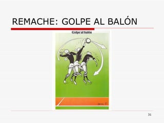 REMACHE: GOLPE AL BALÓN 