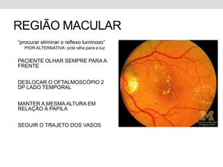 REGIÃO MACULAR
• “procurar eliminar o reflexo luminoso”
• PIOR ALTERNATIVA: pcte olha para a luz
• PACIENTE OLHAR SEMPRE PARA A
FRENTE
• DESLOCAR O OFTALMOSCÓPIO 2
DP LADO TEMPORAL
• MANTER A MESMA ALTURA EM
RELAÇÃO À PAPILA
• SEGUIR O TRAJETO DOS VASOS
 
