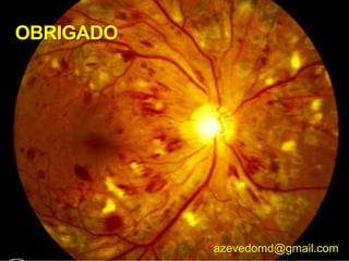 OBRIGADO
azevedomd@gmail.com
 