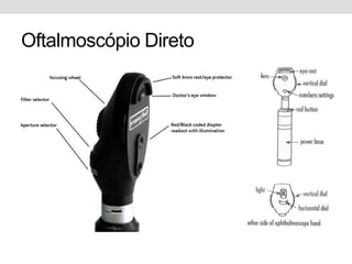 Oftalmoscópio Direto
 