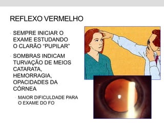 REFLEXO VERMELHO
• SEMPRE INICIAR O
EXAME ESTUDANDO
O CLARÃO “PUPILAR”
• SOMBRAS INDICAM
TURVAÇÃO DE MEIOS
CATARATA,
HEMORRAGIA,
OPACIDADES DA
CÓRNEA
• MAIOR DIFICULDADE PARA
O EXAME DO FO
 