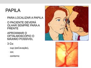 PAPILA
• PARA LOCALIZAR A PAPILA
• O PACIENTE DEVERÁ
OLHAR SEMPRE PARA A
FRENTE
• APROXIMAR O
OFTALMOSCÓPIO O
MÁXIMO POSSÍVEL
• 3 Cs:
• cup (esCavação),
• cor,
• contorno
 