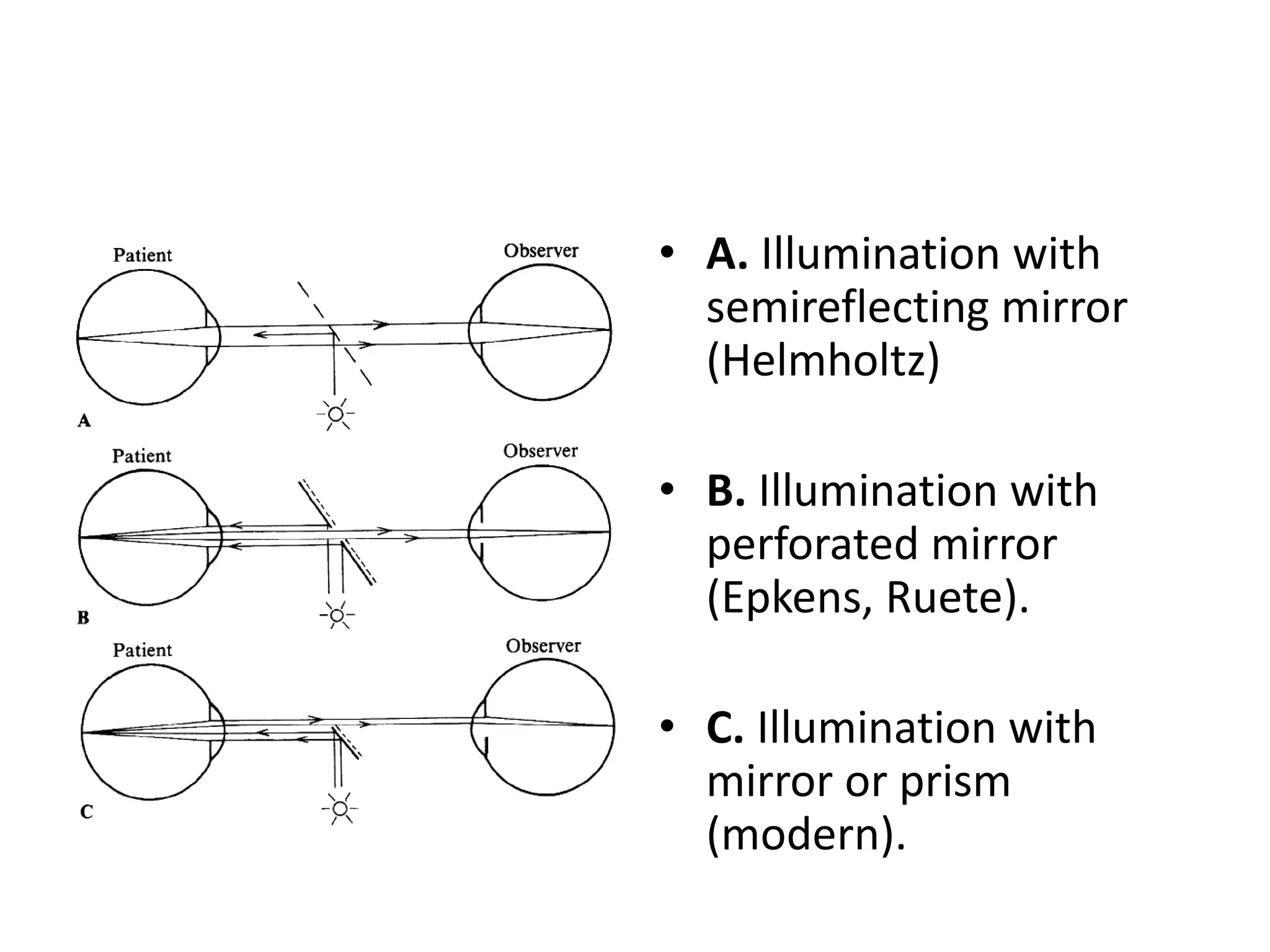 • A. Illumination with
semireflecting mirror
(Helmholtz)
• B. Illumination with
perforated mirror
(Epkens, Ruete).
• C. Illumination with
mirror or prism
(modern).

 