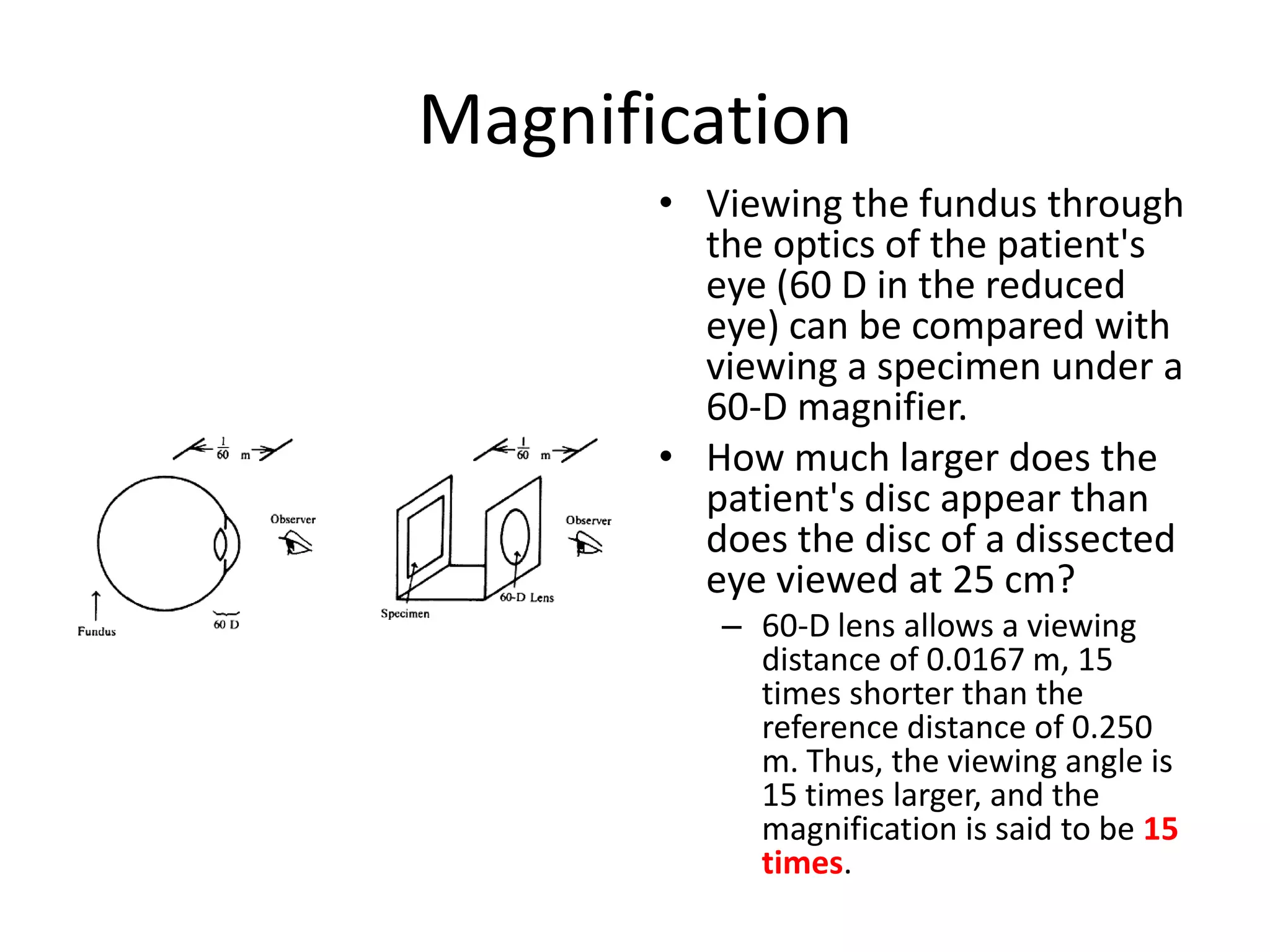 Magnification
• Viewing the fundus through
the optics of the patient's
eye (60 D in the reduced
eye) can be compared with
viewing a specimen under a
60-D magnifier.
• How much larger does the
patient's disc appear than
does the disc of a dissected
eye viewed at 25 cm?
– 60-D lens allows a viewing
distance of 0.0167 m, 15
times shorter than the
reference distance of 0.250
m. Thus, the viewing angle is
15 times larger, and the
magnification is said to be 15
times.

 